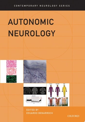 Autonomic Neurology (Contemporary Neurology Series Book 86)