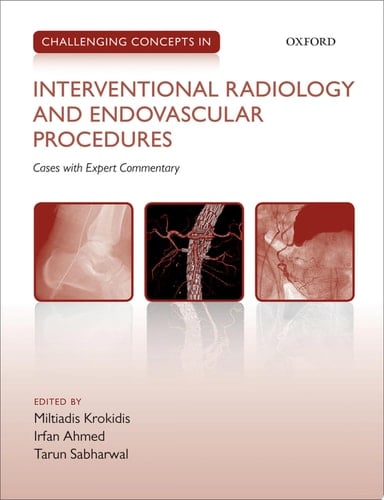 Challenging Concepts in INTERVENTIONAL RADIOLOGY (Challenging Cases)