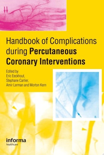 Handbook of Complications During Percutaneous Cardiovascular Interventions