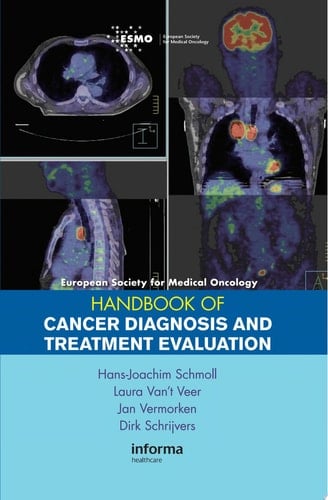 ESMO Handbook of Cancer Diagnosis and Treatment Evaluation