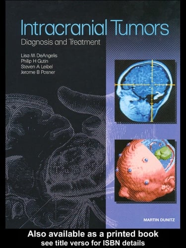 Intracranial Tumors