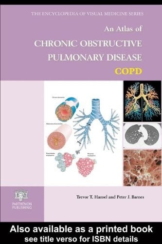An Atlas of Chronic Obstructive Pulmonary Disease on CD-Rom