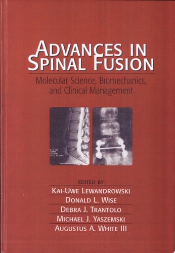 Advances in Spinal Fusion: Molecular Science, BioMechanics, and Clinical Management