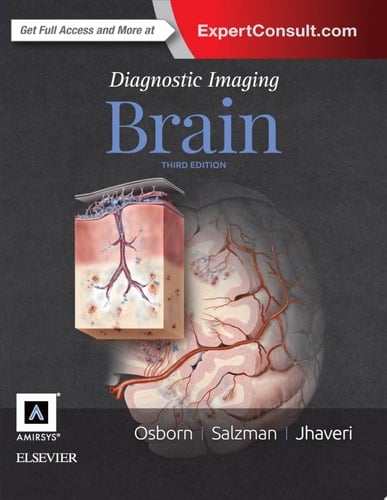 Diagnostic Imaging: Brain