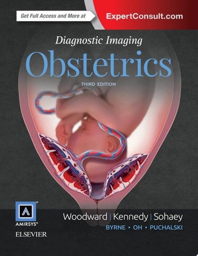 Diagnostic Imaging: Obstetrics E-Book Diagnostic Imaging: Obstetrics E-Book