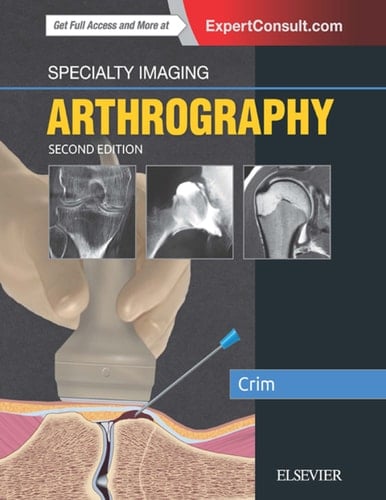 Specialty Imaging: Arthrography