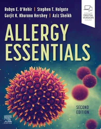 Allergy Essentials,E-Book
