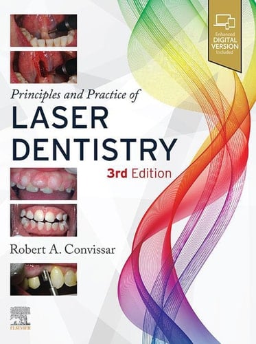 Principles and Practice of Laser Dentistry