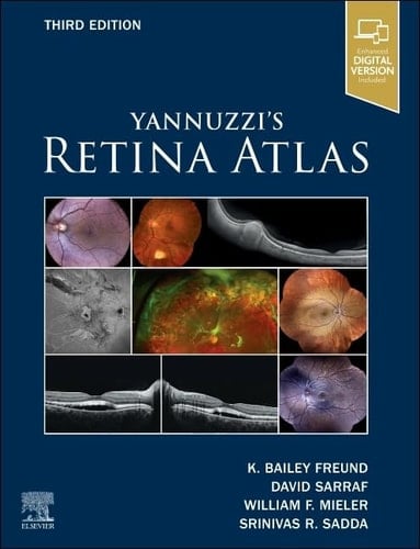 Yannuzzi's Retina Atlas