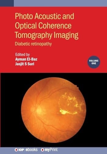 Photo Acoustic and Optical Coherence Tomography Imaging, Volume 1 Diabetic Retinopathy