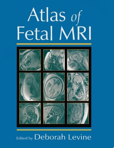 Atlas of Fetal MRI