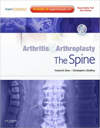 Arthritis and Arthroplasty The spine