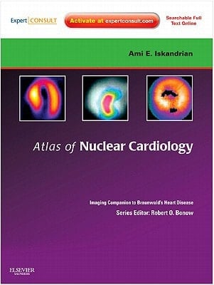 Atlas of Nuclear Cardiology: Imaging Companion to Braunwald's Heart Disease Expert Consult - Online and Print