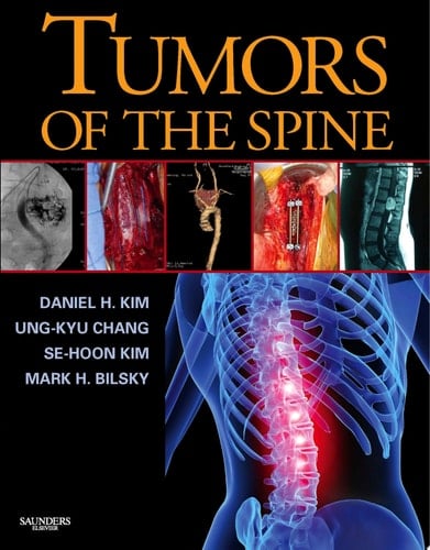 Tumors of the Spine E-Book