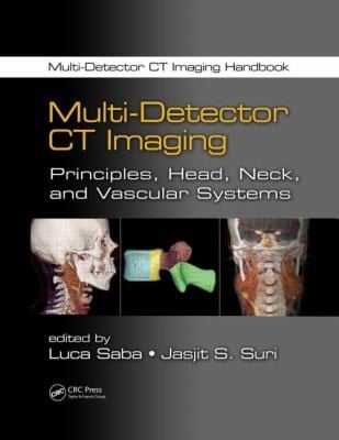 Multidetector Ct Imaging