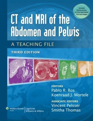 CT  MRI of the Abdomen and Pelvis