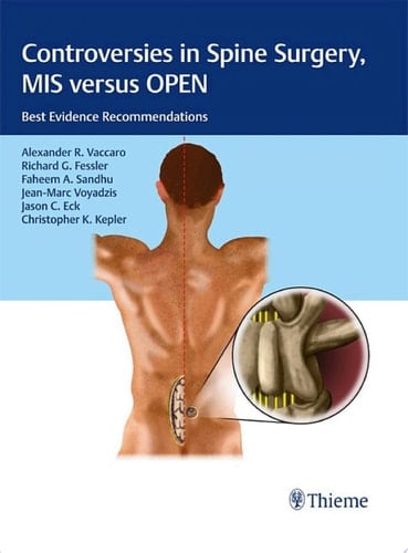 Controversies in Spine Surgery, MIS versus OPEN Best Evidence Recommendations