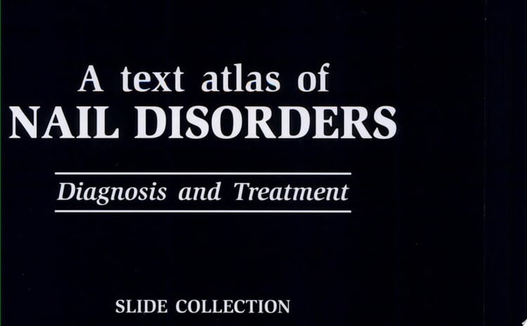 A Text Atlas of Nail Disorders: slide atlas