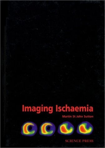 Imaging Ischaemia