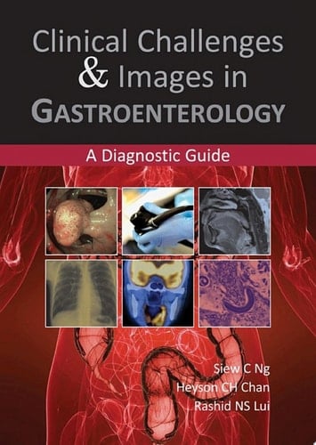 Clinical Challenges & Images in Gastroenterology A Diagnostic Guide
