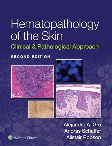 Hematopathology of the Skin Clinical & Pathological Approach