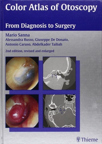 Color Atlas of Otoscopy From Diagnosis to Surgery