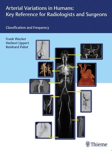 Arterial Variations in Humans: Key Reference for Radiologists and Surgeons Classification and Frequency