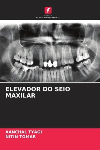 ELEVADOR DO SEIO MAXILAR (Portuguese Edition)