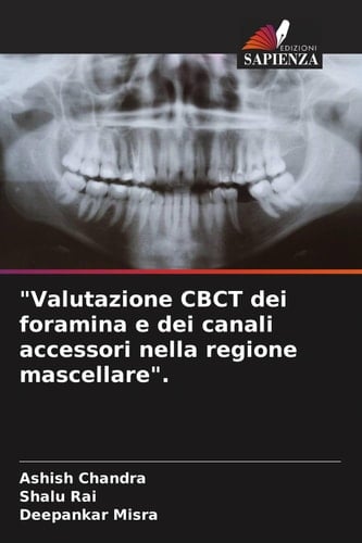 "Valutazione CBCT dei foramina e dei canali accessori nella regione mascellare". (Italian Edition)