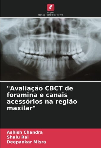 "Avaliação CBCT de foramina e canais acessórios na região maxilar" (Portuguese Edition)