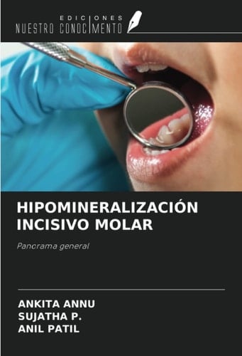 HIPOMINERALIZACIÓN INCISIVO MOLAR: Panorama general (Spanish Edition)
