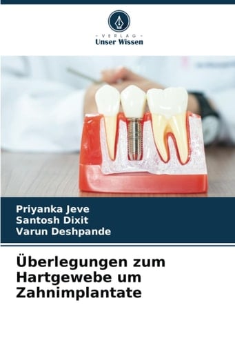 Überlegungen zum Hartgewebe um Zahnimplantate (German Edition)