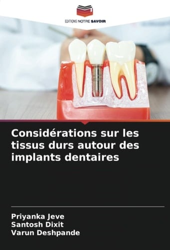 Considérations sur les tissus durs autour des implants dentaires (French Edition)