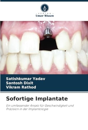Sofortige Implantate: Ein umfassender Ansatz für Geschwindigkeit und Präzision in der Implantologie (German Edition)