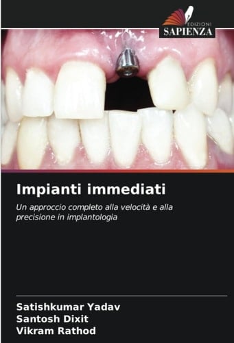 Impianti immediati: Un approccio completo alla velocità e alla precisione in implantologia (Italian Edition)