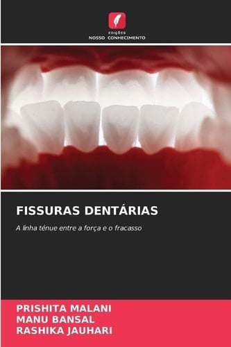 Fissuras Dentárias