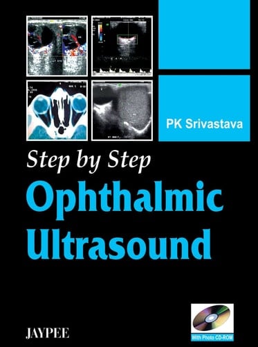 Step by Step Ophthalmic Ultrasound with Photo CD-ROM by Srivastava