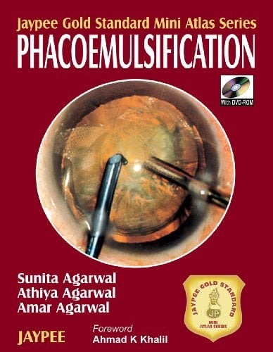 Phacoemulsification with DVD ROM (Jaypee Gold Standard Mini Atlas Series)