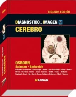 Diagnstico por imagen cerebro