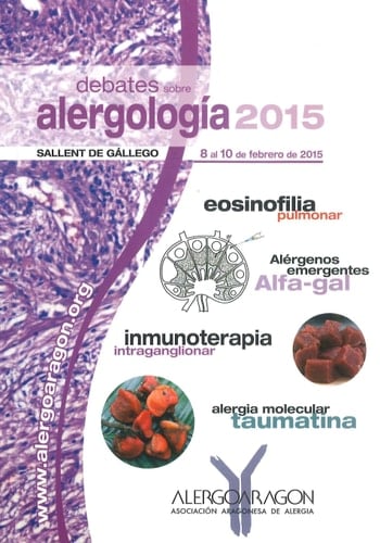 Debates sobre alergología