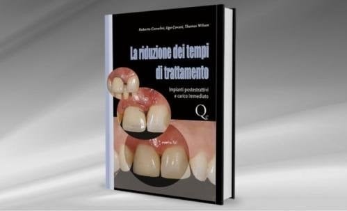 La riduzione dei tempi di trattamento. Impianti postestrattivi e carico immediato