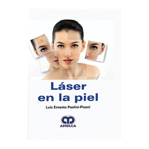 Láser en la Piel