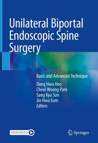 Unilateral Biportal Endoscopic Spine Surgery Basic and Advanced Technique
