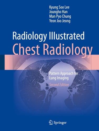 Radiology Illustrated: Chest Radiology Pattern Approach for Lung Imaging
