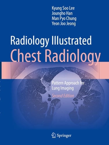 Radiology Illustrated: Chest Radiology Pattern Approach for Lung Imaging