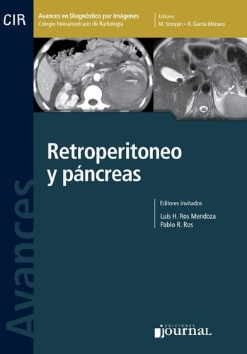 Avances en diagnóstico por imágenes: Retroperitoneo y páncreas