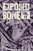 Exposed Bone Volume II