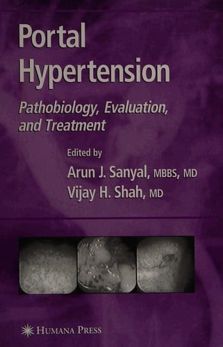 Portal hypertension