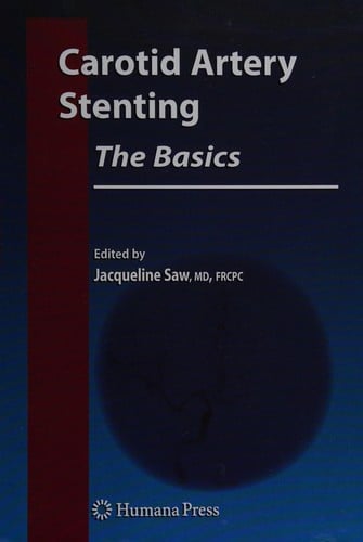 Carotid artery stenting