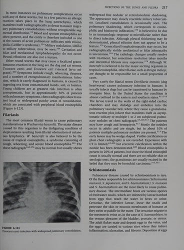 Imaging of diseases of the chest